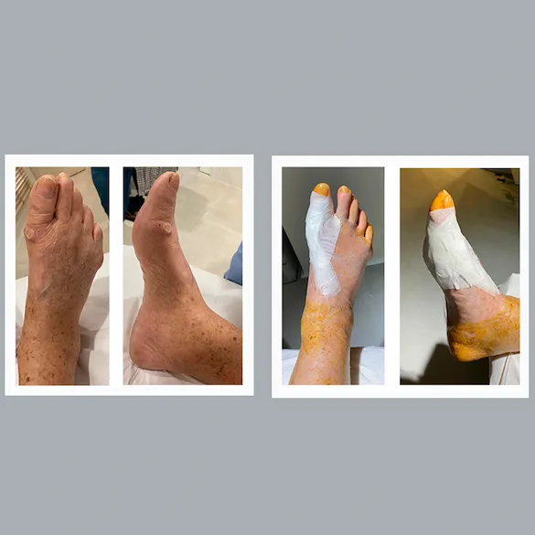 Dr. Soler Traumatólogo Pie